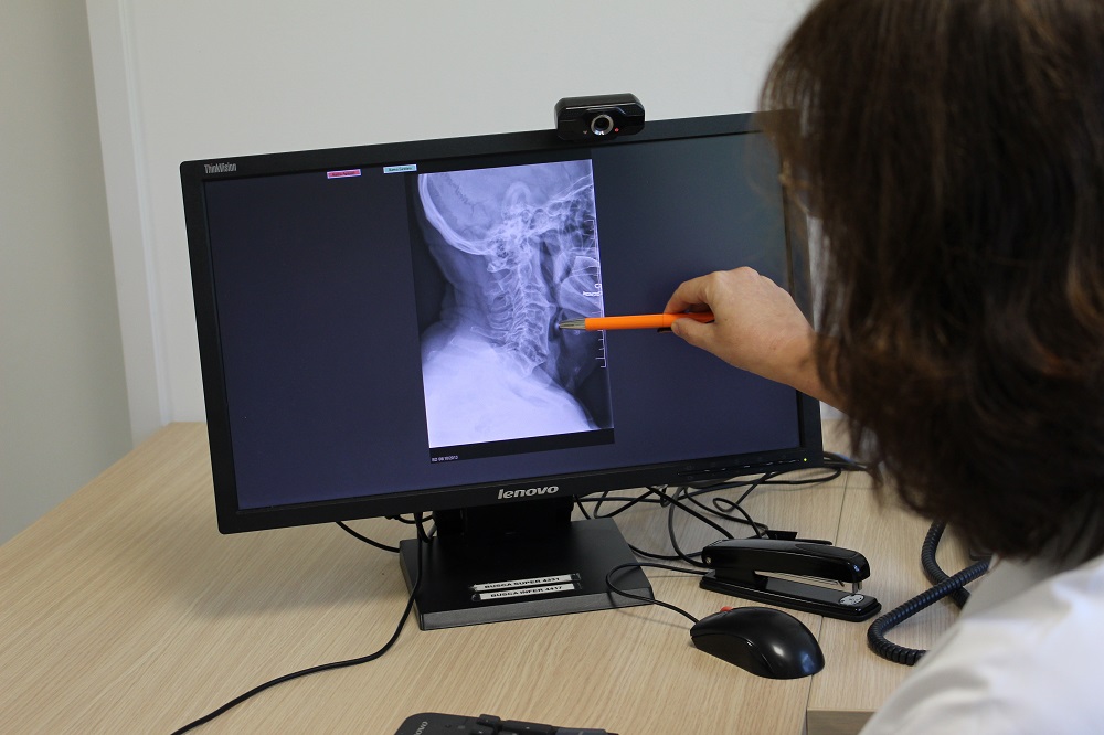 La Dra. Claveguera mostrant una columna vertebral fusionada.