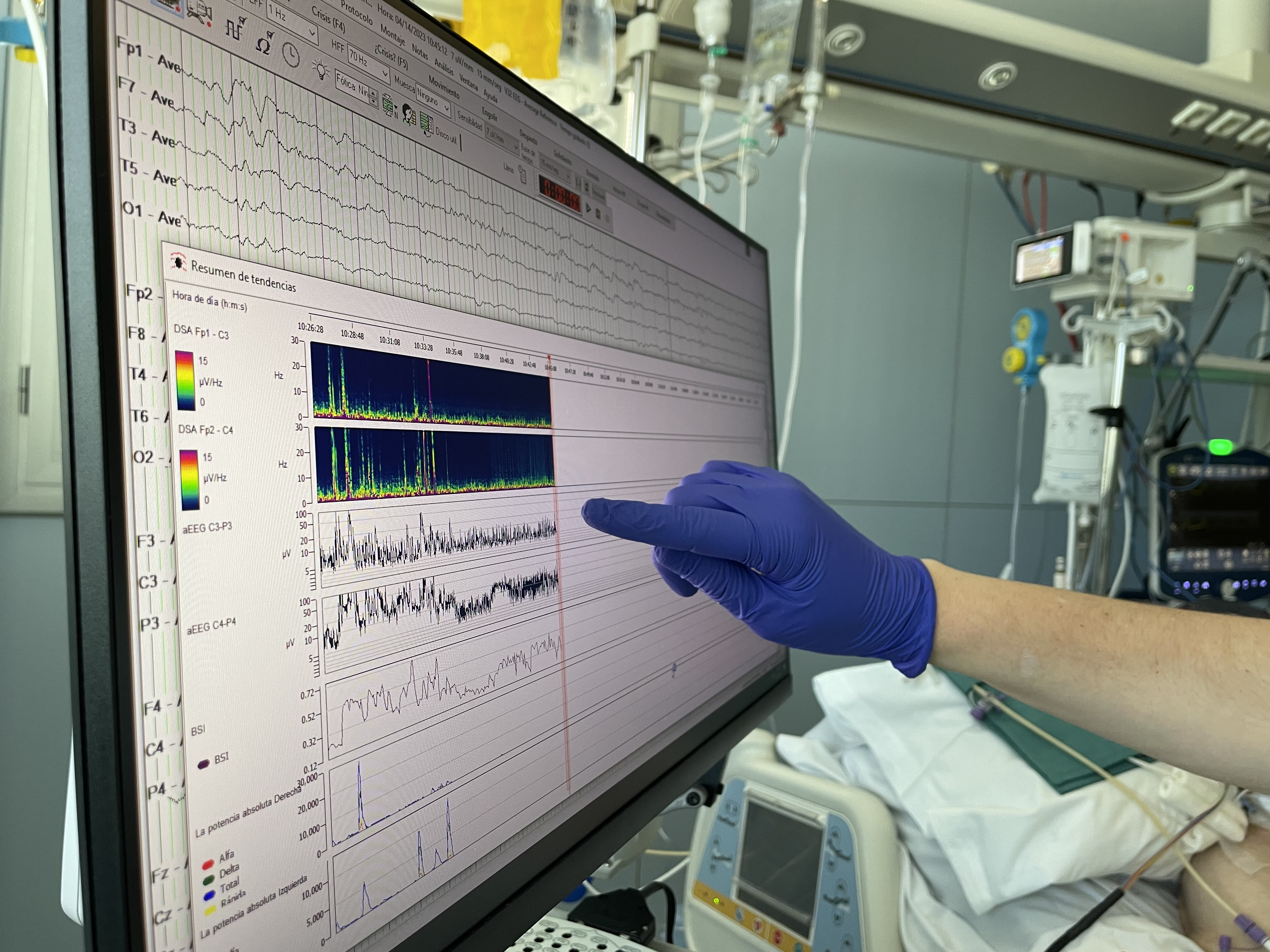 L'aparell de la UCI mesura l'activitat elèctrica del cervell.